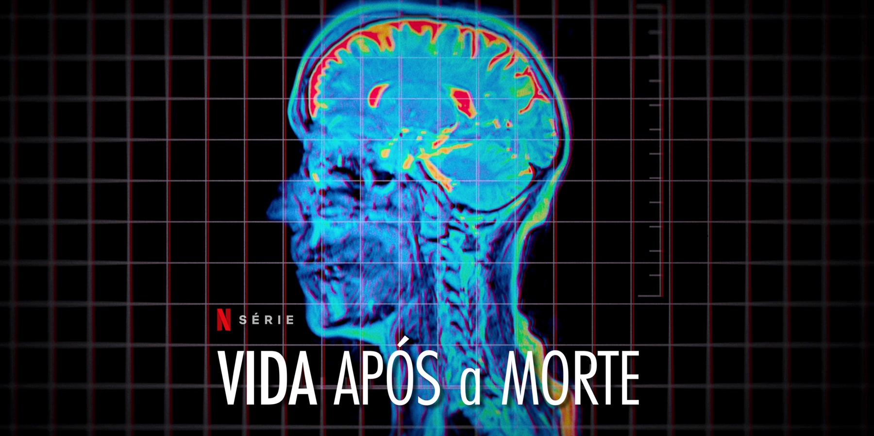 Vida Após a Morte: há um antes e depois?