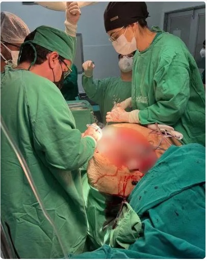 Médico retira tumor de 46 kg da barriga de paciente: ‘Desse tamanho, eu nunca vi’