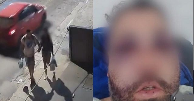 Casal é agredido brutalmente com pedras e pauladas em Campo Grande